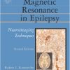 MAGNETIC RESOANANCE IN EPILEPSY, 2E