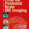 ATLAS OF FETAL AND NEONATAL BRAIN MR