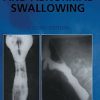 Normal And Abnormal Swallowing: Imaging In Diagnosis And Therapy, 2/E