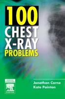 100 Chest X-Ray Problems Ie (Pb 2007)