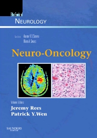 Neuro Oncology Blue Books Of Neurology Series (Hb 2010)
