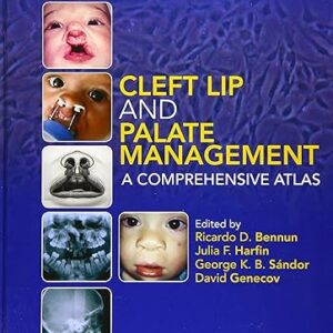 Cleft Lip And Palate Management A Comprehensive Atlas Hb 2016