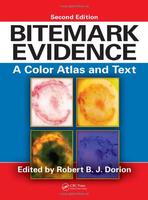 Bitemark Evidence A Color Atlas And Text 2Ed (Hb 2011)