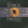 Atlas Of Allergic Diseases, 2E