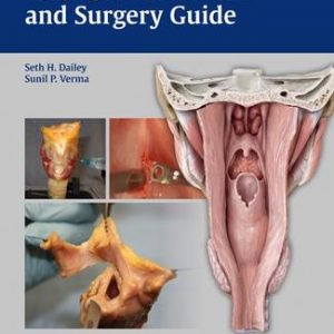 Laryngeal Dissection And Surgery Guide (Pb 2013)
