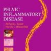 Pelvic Inflammatory Disease