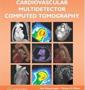 Atlas And Manual Of Cardiovascular Multidetector Computed Tomography