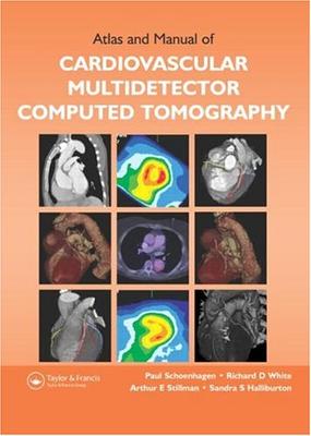 9781842143025 1 | Atlas And Manual Of Cardiovascular Multidetector Computed Tomography | 9781842143025 | Together Books Distributor Atlas And Manual Of Cardiovascular Multidetector Computed Tomography