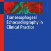 Transesophageal Echocardiography In Clinical Practice