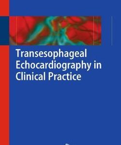 Transesophageal Echocardiography In Clinical Practice