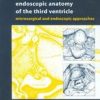 Endoscopic Anatomy Of The Third Ventricle (Hb)