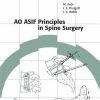 Ao Asif Principles In Spine Surgery: Techniques Recommended By The Ao/Asif Group, Spine Education