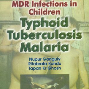 Common Mdr Infections In Children Typhoid Tuberculosis Malaria