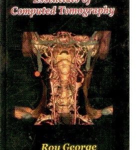 Essentials Of Computed Tomography