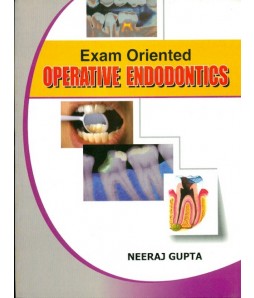 Exam Oriented Operative Endodontics