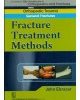 Fracture Treatment Methods (Handbook In Orthopedics And Fractures Vol.02 - Orthopedic Trauma General Fractures)