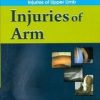 Injuries Of Arm ((Handbook In Orthopedics And Fractures Series, Vol. 6 - Orthopedic Trauma Injuries Of Upper Limb)