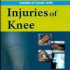 Injuries Of Knee (Handbook Of Orthopedics And Fractures Series, Vol. 15: Orthopedic Trauma Injuaries Of Lower Limb)