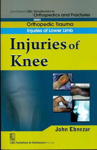 9788123920887 1 | Injuries Of Knee Handbook Of Orthopedics And Fractures Series Vol 15: Orthopedic Trauma Injuaries Of Lower Limb | 9788123920887 | Together Books Distributor Injuries Of Knee (Handbook Of Orthopedics And Fractures Series, Vol. 15: Orthopedic Trauma Injuaries Of Lower Limb)