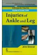 Injuries Of Ankle And Leg (Handbook Of Orthopedics And Fratures Series, Vol. 17: Orthopedic Trauma  Injuries Of Lower Limb)