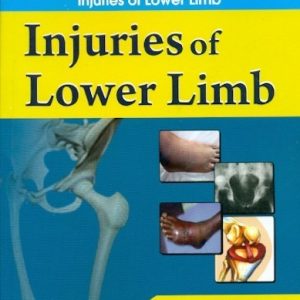 Injuries Of Lower Limb (Handbook In Orthopedics And Fractures Vol.19 - Orthopedic Trauma Injuries Of Lower Limb)