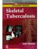 Skeletal Tuberculosis (Handbooks In Orthopedics And Fractures Series, Vol.33: Orthopedic Diseases)