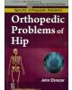 Orthopedic Problems Of Hip (Handbooks In Orthopedics And Fractures Series, Vol. 40: Specific Orthopedic Problems)