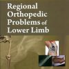 Regional Orthopedic Problems Of Lower Limb (Handbooks In Orthopedics And Fractures Series, Vol. 49: Regional Orthopedic Problems)