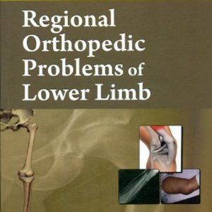Regional Orthopedic Problems Of Lower Limb (Handbooks In Orthopedics And Fractures Series, Vol. 49: Regional Orthopedic Problems)