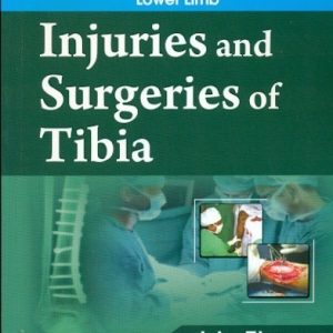 Injuries And Surgeries Of Tibia (Handbooks In Orthopedics And Fractures Series, Vol. 57: Orthopedic Injuries And Surgeries Lower Limb)