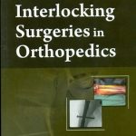 Interlocking Surgeries In Orthopedics (Handbooks In Orthopedics And Fractures Series, Vol. 60-Orthopedic Injuries And Surgeries)