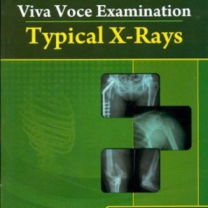 Typical X Rays Handbooks In Orthopedics And Fractures Series Vol 65 Practical Examination