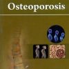 Osteoporosis (Handbooks In Orthopedics And Fractures Series, Vol.90 - Common Orthopedic Problems)