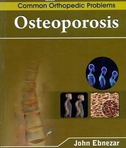 Osteoporosis (Handbooks In Orthopedics And Fractures Series, Vol.90 - Common Orthopedic Problems)