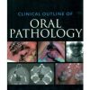 Clinical Outline Of Oral Pathology 4Ed (Pb)