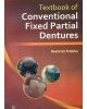 Textbook Of Conventional Fixed Partial Dentures (Pb-2014)
