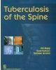 Tuberculosis Of The Spine (Hb 2014)