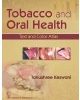 Tobacco And Oral Health Text And Color Atlas (Pb 2016)