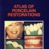 Atlas Of Porcelain Restorations