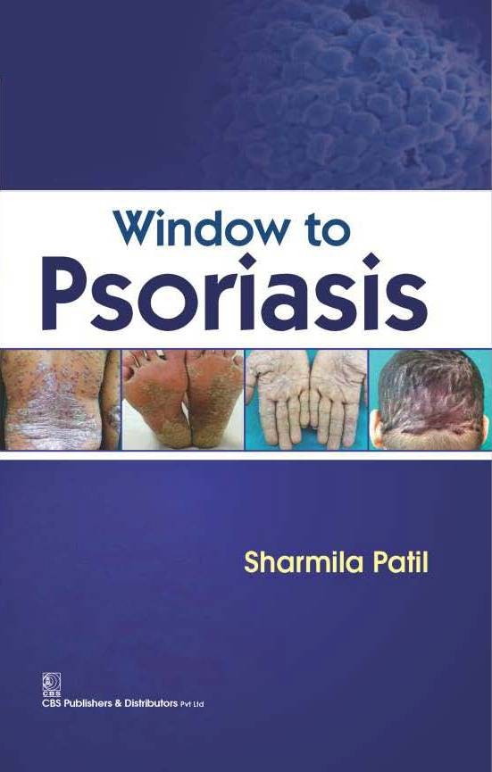 Window To Psoriasis(Hb 2016)