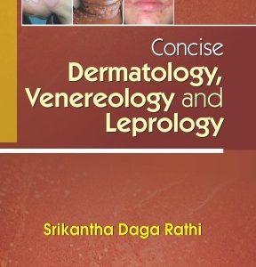 Concise Dermatology Venereology And Leprology (Pb 2017)