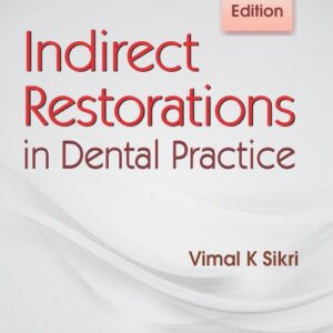 Indirect Restorations In Dental Practice 2Ed (Pb 2017)
