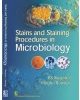 Stains And Staining Procedures In Microbiology (Pb 2017)