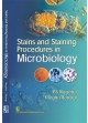 Stains And Staining Procedures In Microbiology (Pb 2017)