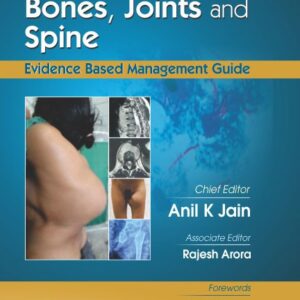 Tuberculosis Of Bones Joints And Spine (Hb 2017)