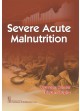 Severe Acute Malnutrition (Pb 2017)