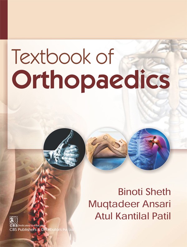 Textbook Of Orthopaedics (Pb 2018)