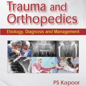 Trauma And Orthopedics Etiology Diagnosis And Management (Pb 2017)