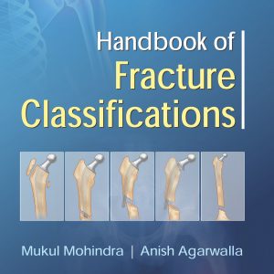 Handbook Of Fracture Classifications (Pb 2017)