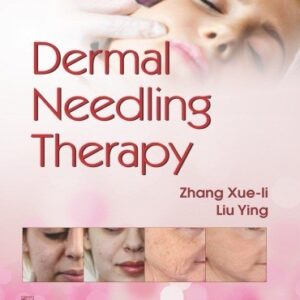 Dermal Needling Therapy (Pb 2019)
